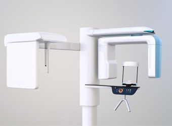 an example of a 3 D cone beam scanner