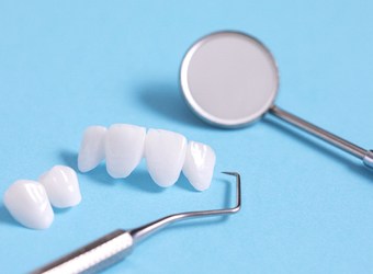 Dental instruments lying next to different types of dental bridges