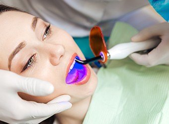 woman getting dental sealants