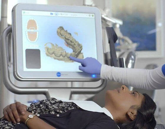 digital impressions technology