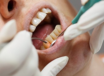 a patient undergoing laser periodontal treatment