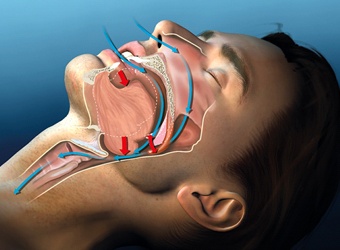 image of airway