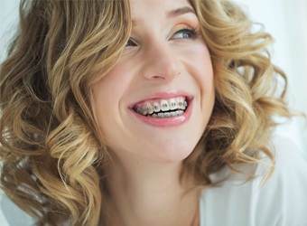 young woman with braces