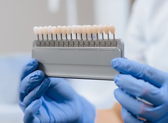 Dentist with blue gloves holding shade scale